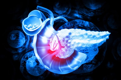 Un caso ‘unico’ di adenocarcinoma duttale pancreatico (PDAC)