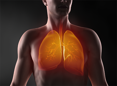 Nintedanib nella malattia polmonare interstiziale fibrosante
