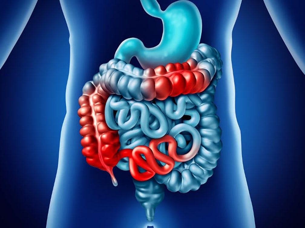 Malattia di Crohn: ok del CHMP per risankizumab di AbbVie