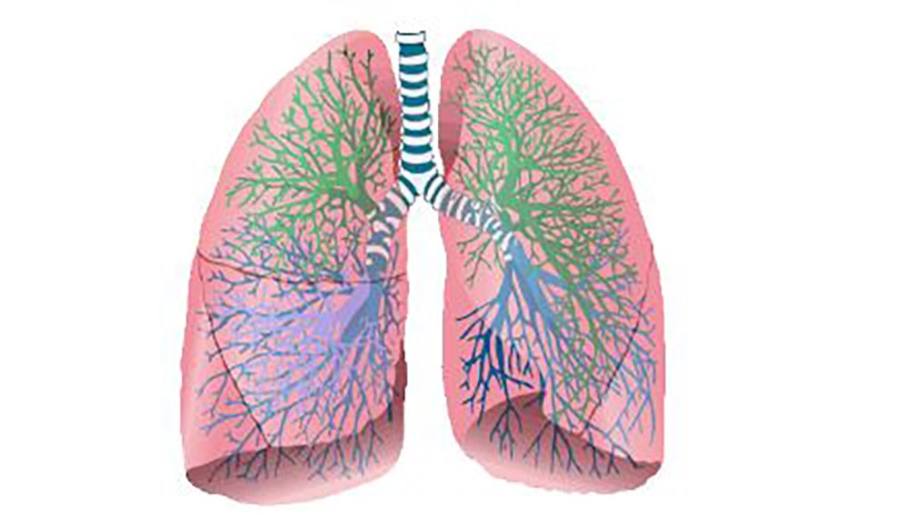 Ok sotatercept per adulti con Ipertensione Arteriosa Polmonare (PAH)