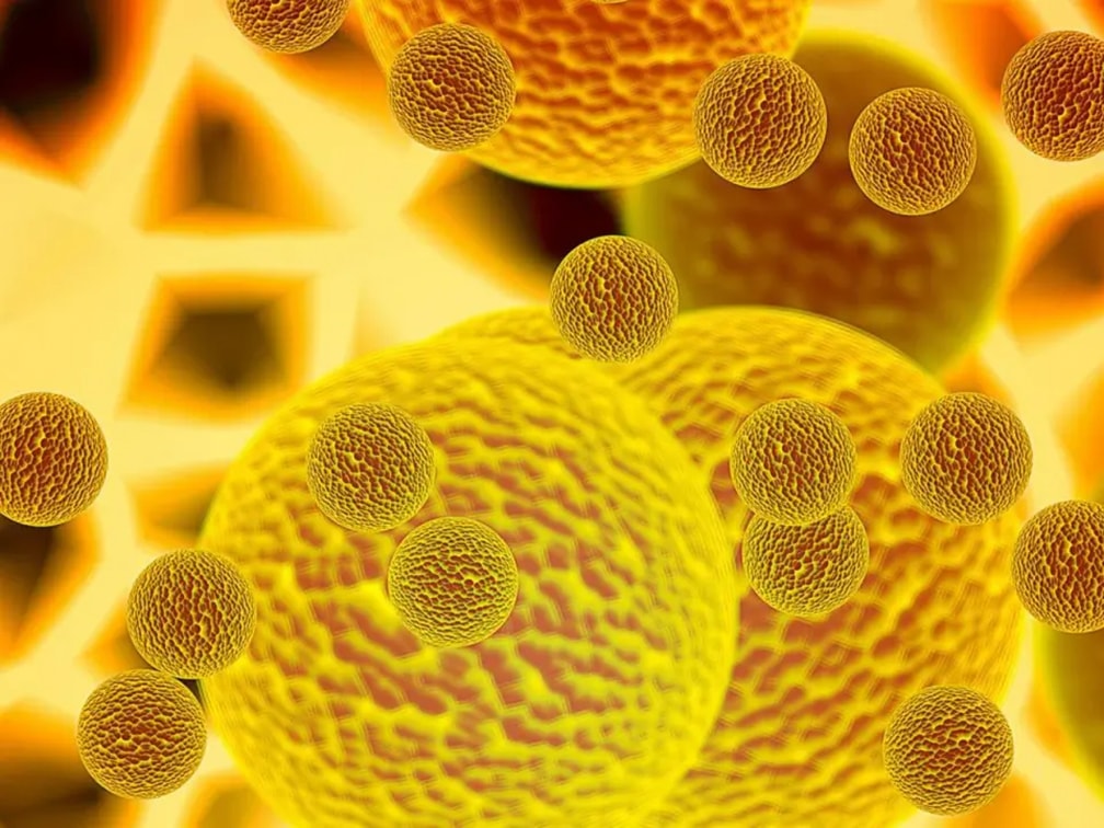 Tumore del rene: Aifa approva nivolumab più cabozantinib