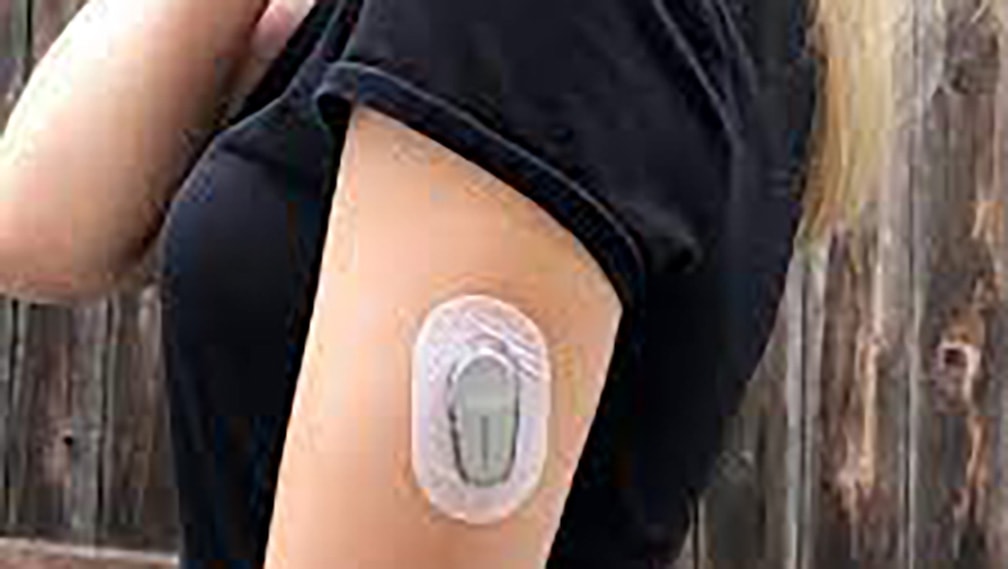 Diabete: disponibile in Italia l’innovativo sistema Dexcom ONE