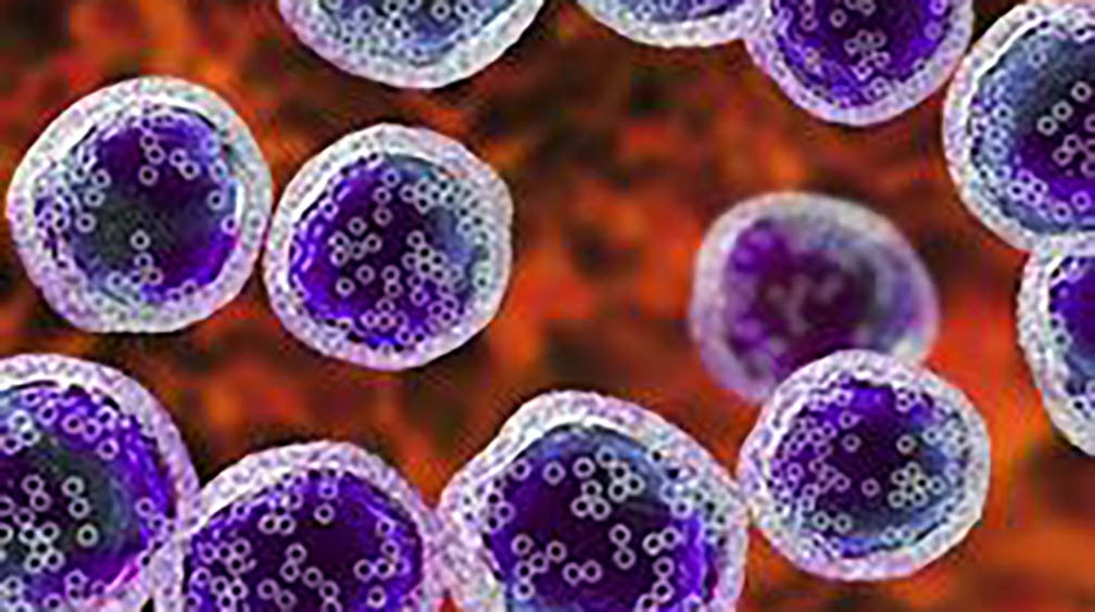 Malattie rare, EMA approva tabelecleucel per pazienti con Epstein-Barr