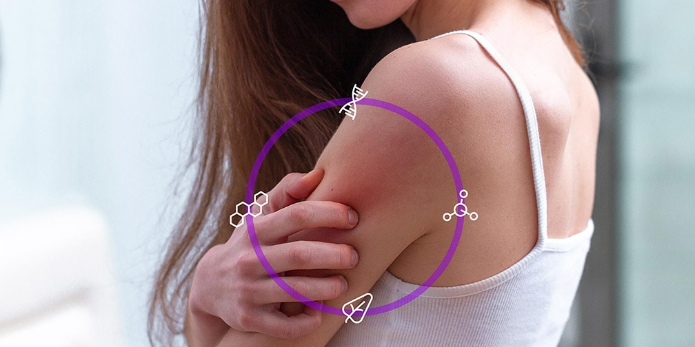 OK Aifa ad upadacitinib per il trattamento della dermatite atopica negli adulti