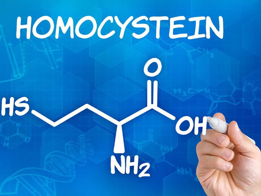 Alimentazione e rischio cerebrovascolare: il ruolo dell’omocisteina