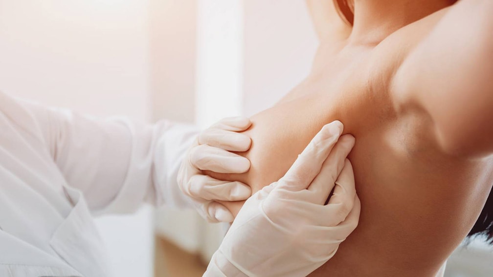 Ok dalla FA aelacestrant per il tumore del seno avanzato o metastatico