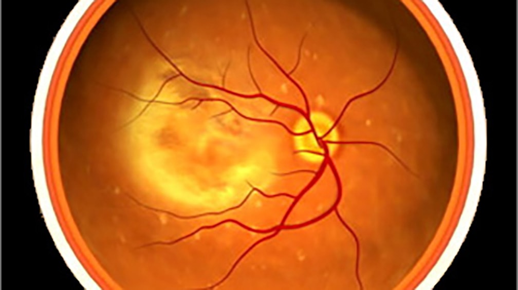Patologia della retina: Bayer sottopone all’EMA aflibercept 8 mg