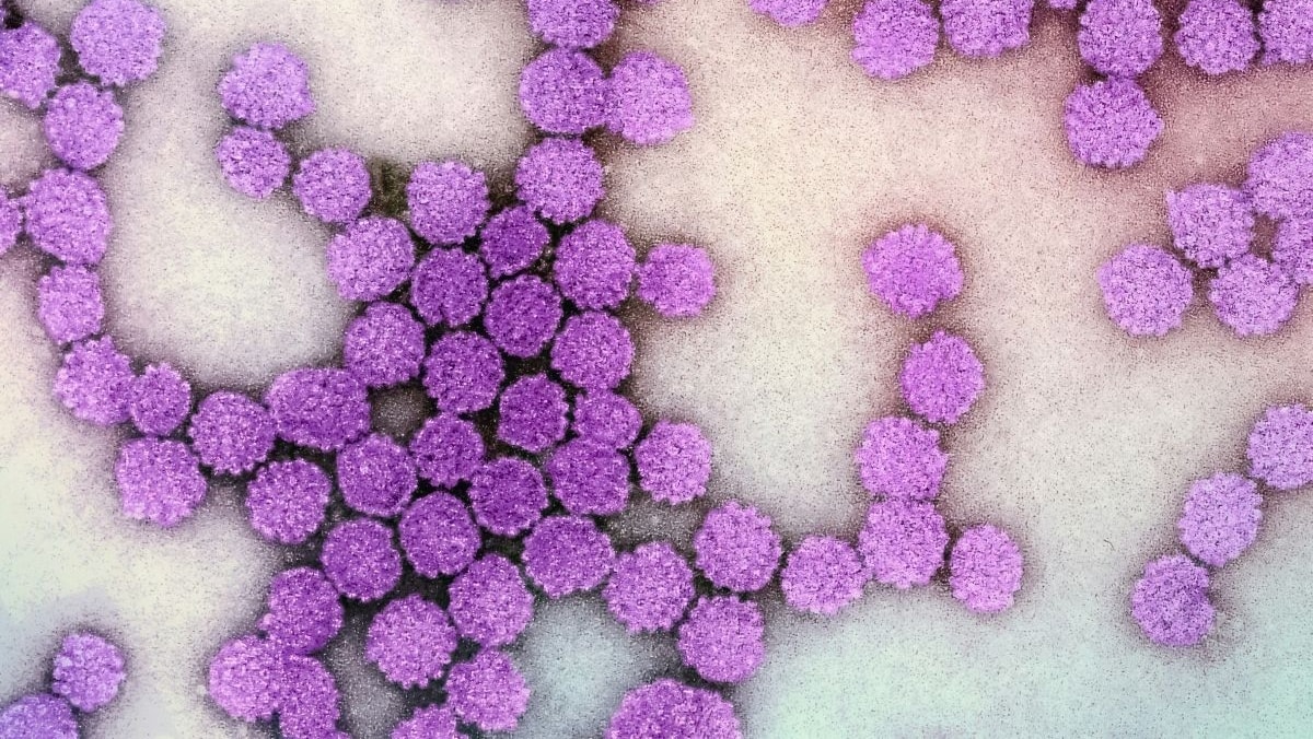 Tumori orofaringei da Hpv, un test per la diagnosi precoce
