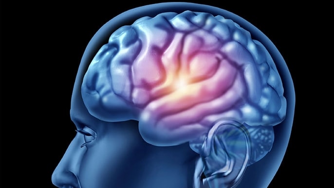 Parkinson, i carotenoidi per predire gli effetti della riabilitazione