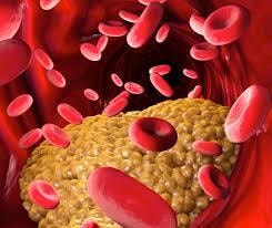 Colesterolo ‘cattivo’ LDL-C, non solo deve essere basso, ma stabile nel tempo