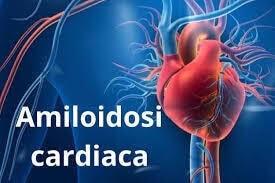 Nuovi dati su acoramidis di Bayer nella cardiomiopatia amiloide da transtiretina